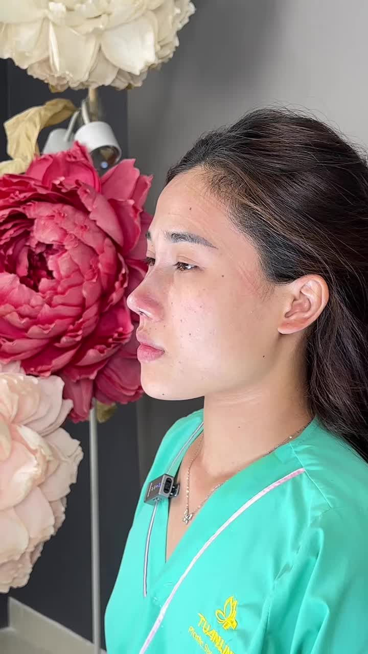 Mũi cấu trúc đục xương vừa hoàn thành