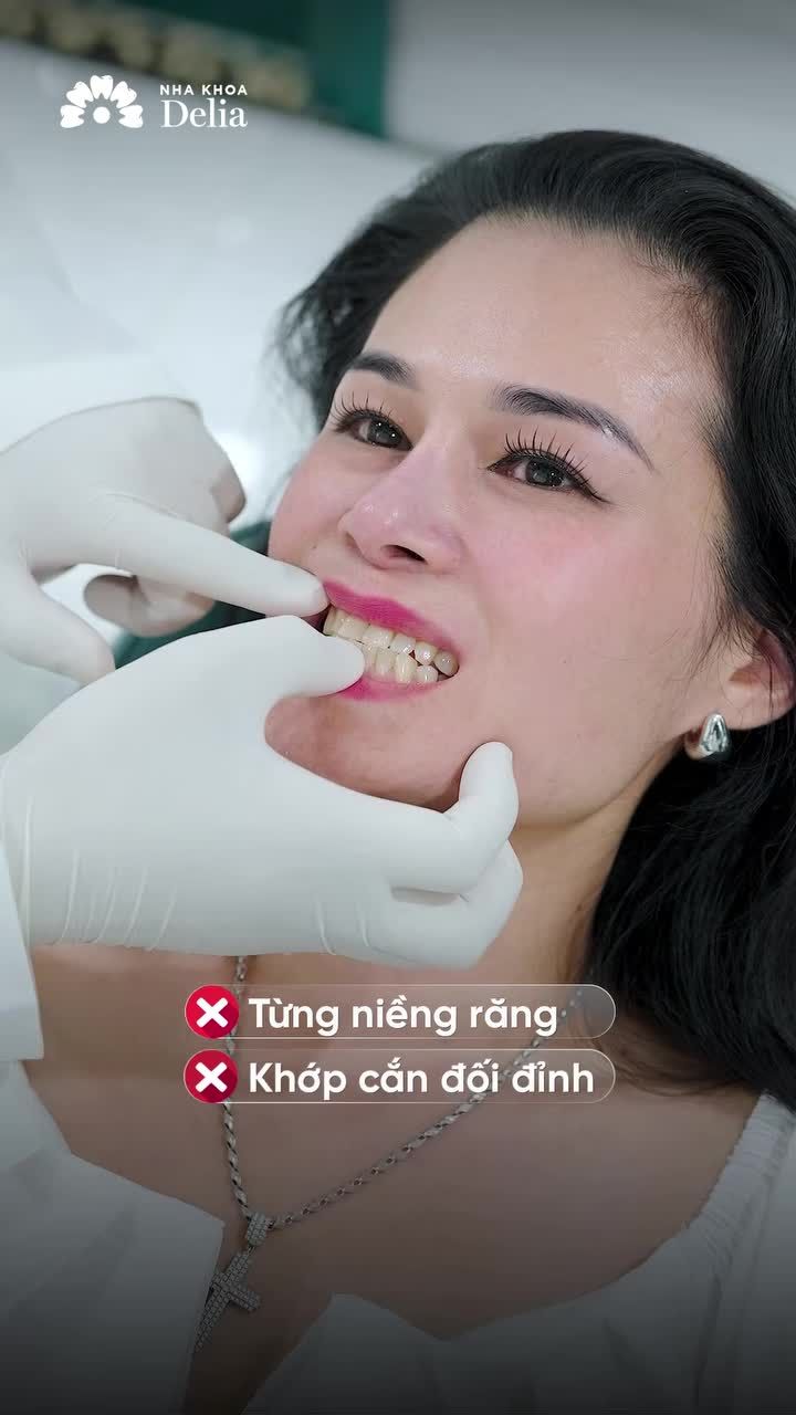 KIỀU BÀO QUYẾT ĐỊNH BỌC RĂNG SỨ SAU 10 NĂM NIỀNG RĂNG