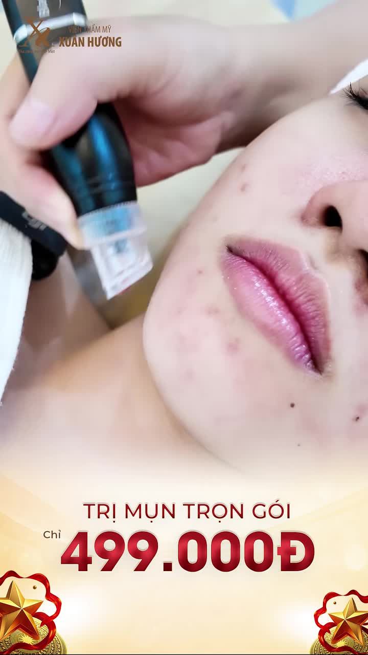 TRỊ MỤN TRỌN GÓI CHỈ VỚI 499K, TIN ĐƯỢC KHÔNG?