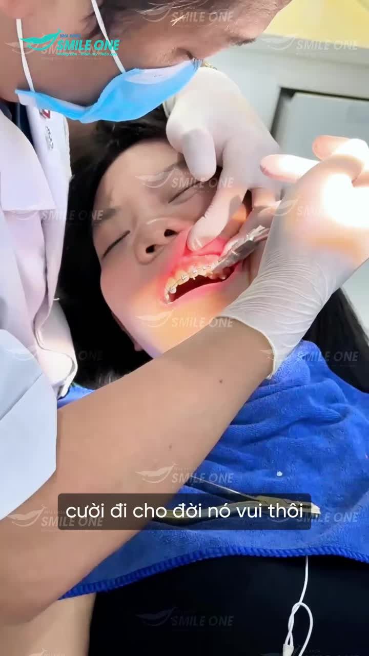 Chỉ cần 6 tháng thôi là đã có thể thoải mái cười mọi lúc mọi nơi rồi!