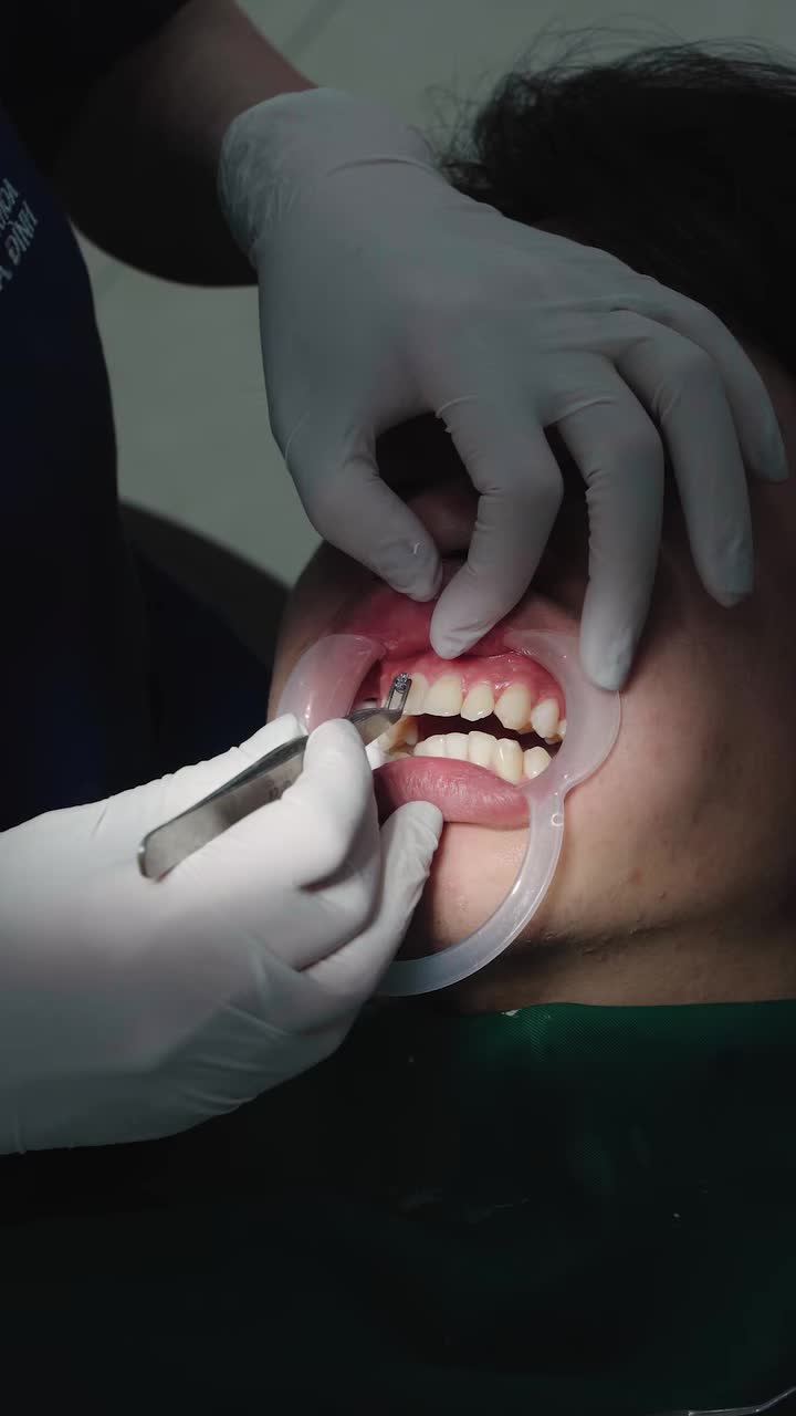 KHÔNG BAO GIỜ LÀ QUÁ MUỘN ĐỂ THAY ĐỔI NỤ CƯỜI