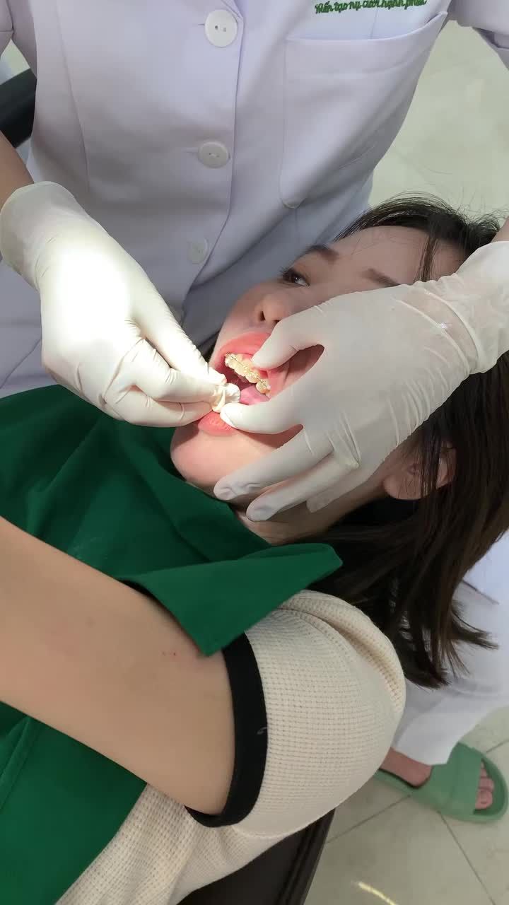 HẾT HÔ, KHỚP CẮN ĐẸP - HUYỀN CHÍNH THỨC THÁO NIỀNG!