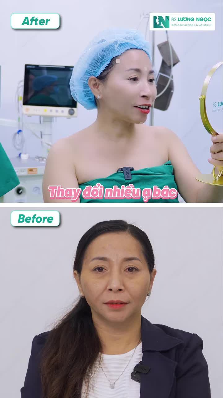 Điều gì khiến một bác sĩ quyết định hút mỡ bụng ở tuổi 32?