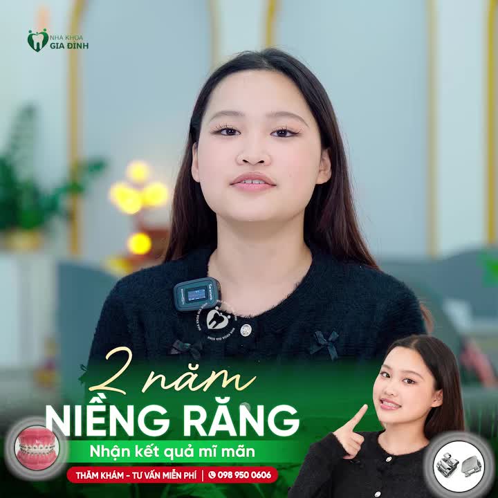 2 NĂM NIỀNG RĂNG - CÁI KẾT ĐẸP CHO MỘT HÀNH TRÌNH KIÊN TRÌ NỖ LỰC