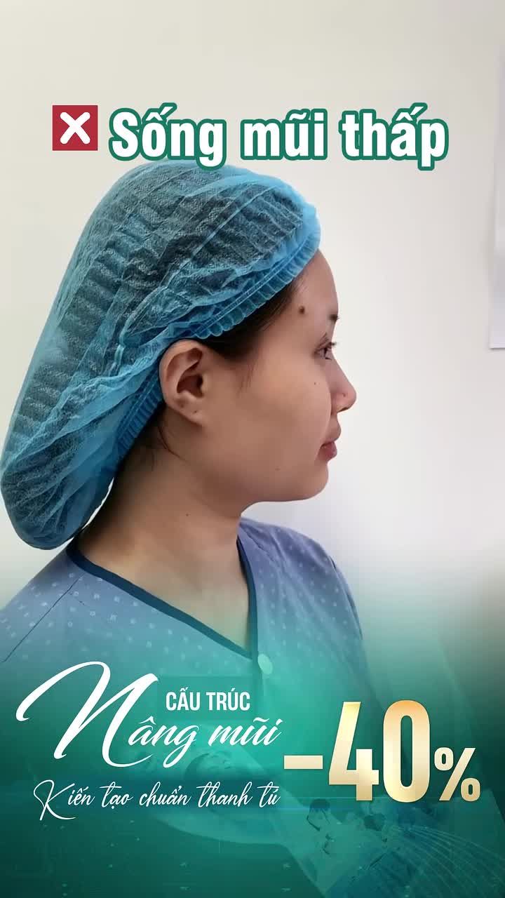 SỰ THAY ĐỔI BẤT NGỜ SAU NÂNG MŨI CẤU TRÚC IS