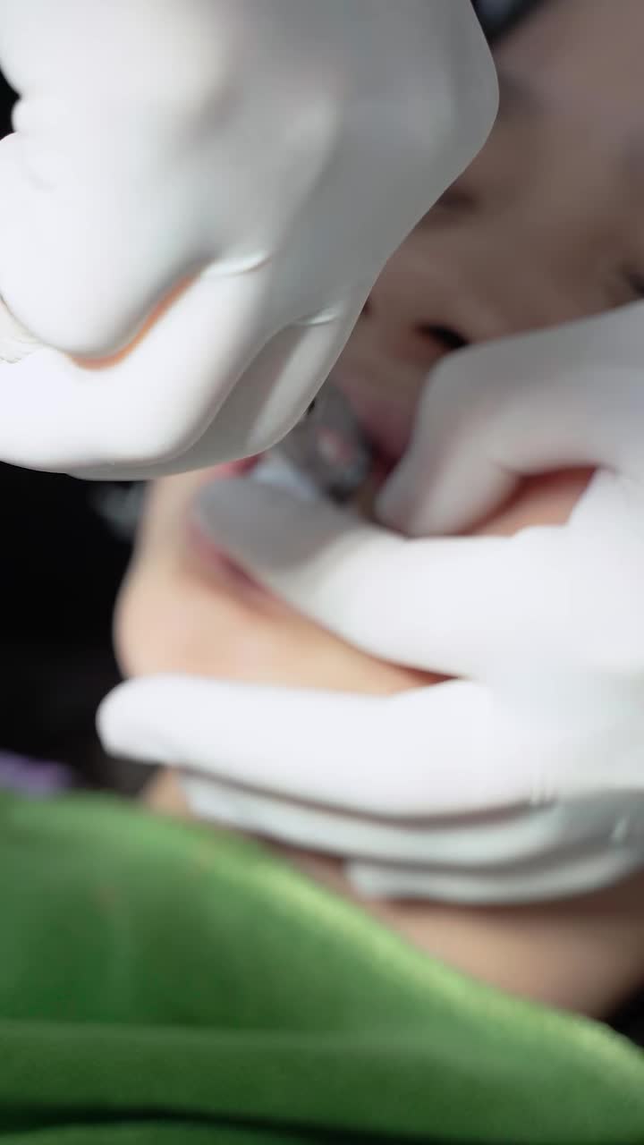 TỰ TI VÌ HÀM RĂNG CHƯA ĐỀU ĐẸP, VÂN ANH ĐÃ XIN BỐ MẸ CHO NIỀNG RĂNG