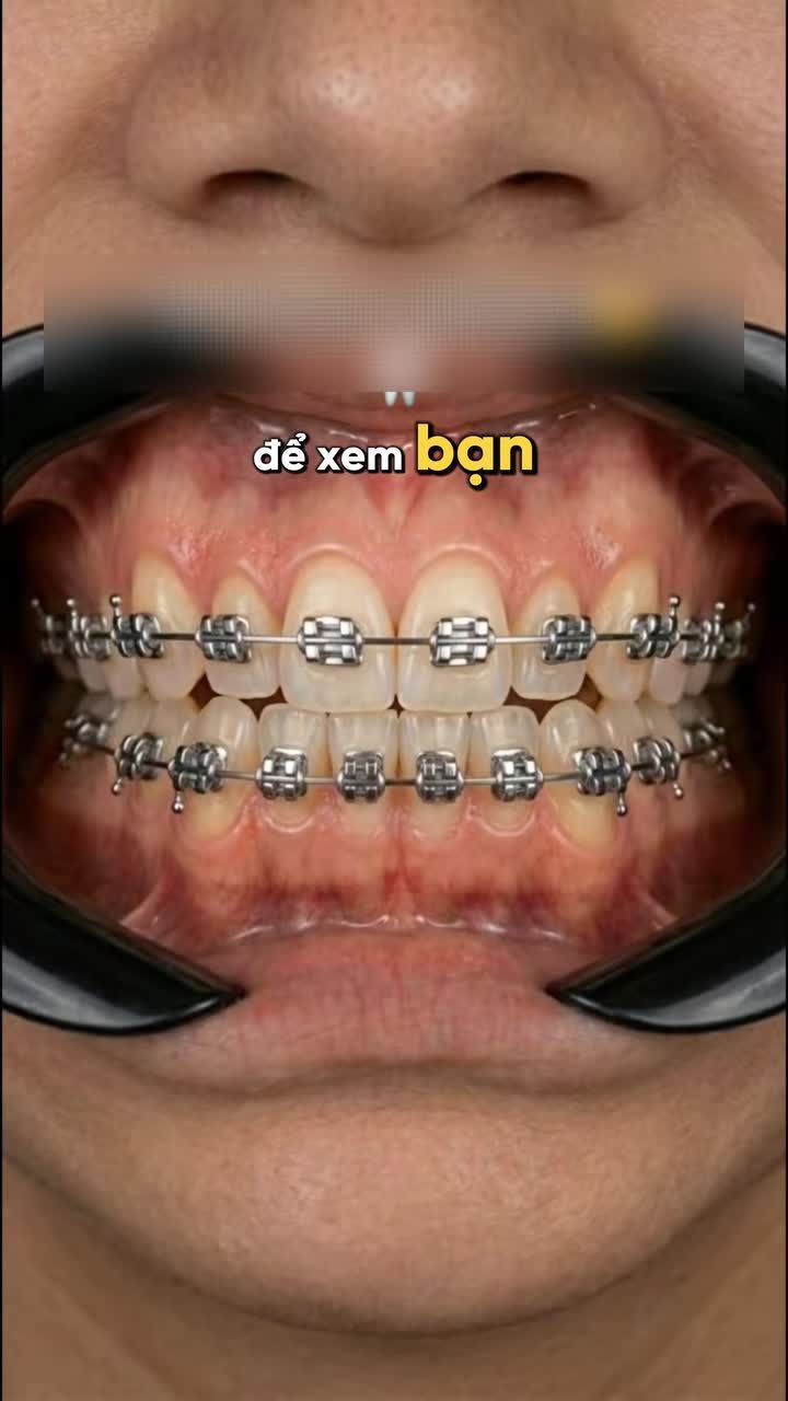 5 TRƯỜNG HỢP NÊN NIỀNG CÀNG SỚM CÀNG TỐT