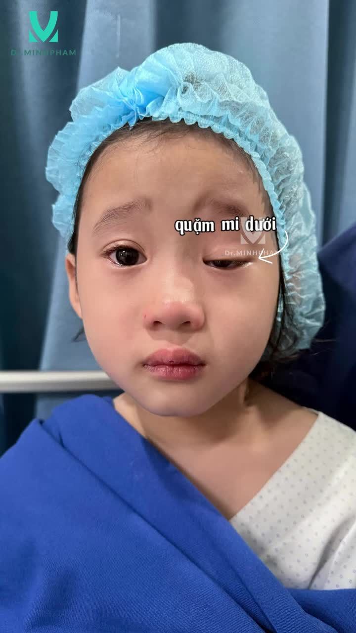 Sau khi thăm khám kỹ lưỡng, Ts.Bs Minh Phạm đã trực tiếp xây dựng phác đồ điều trị và thực hiện phẫu thuật