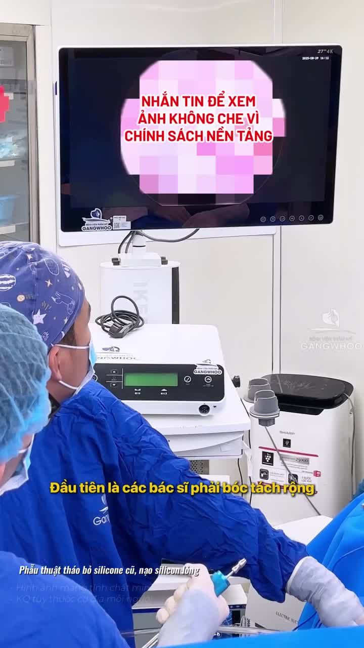 Quy trình xử lý khi phát hiện túi nâng vòng 1 bị vỡ