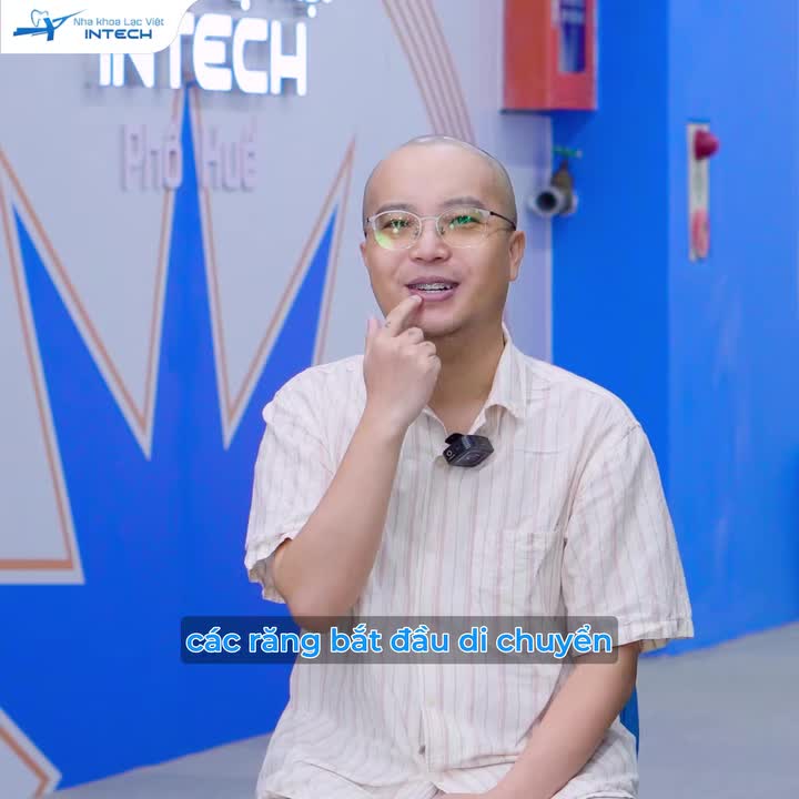 BƯỚC NGOẶT THAY ĐỔI NỤ CƯỜI TUỔI 39 CỦA KHÁCH HÀNG NGƯỜI TRUNG QUỐC SAU NIỀNG RĂNG