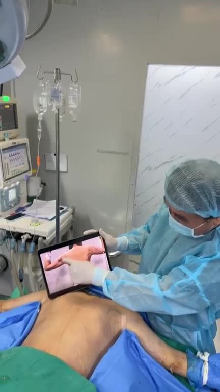 Hút mỡ LƯNG ko SẸO