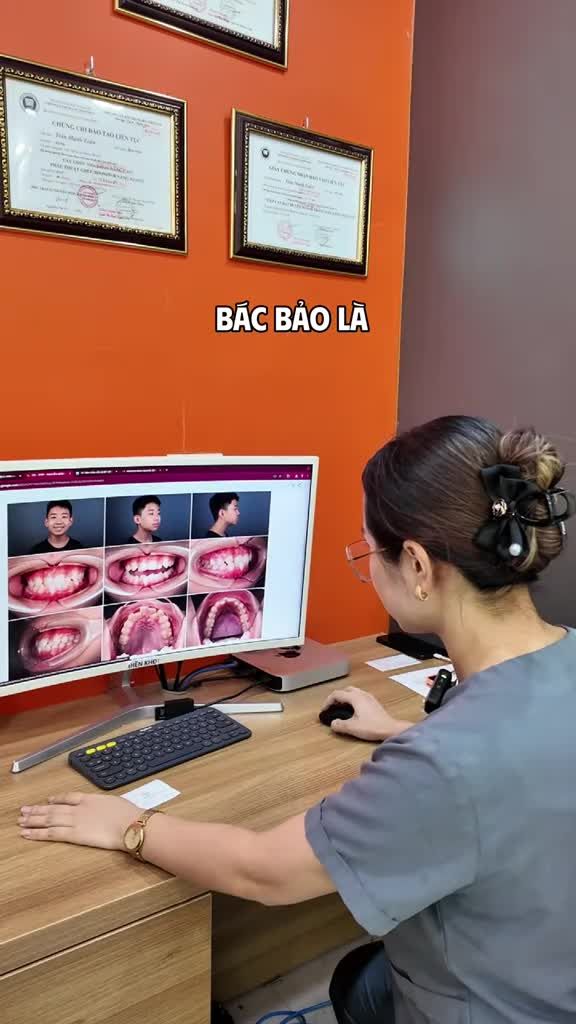 Bố mẹ không biết liệu với tình trạng răng của con thì niềng có cần nhổ răng không?