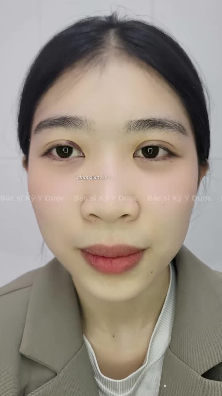 Nâng mũi Aline – Không chỉ nâng dáng mũi, mà còn nâng tầm nhan sắc.