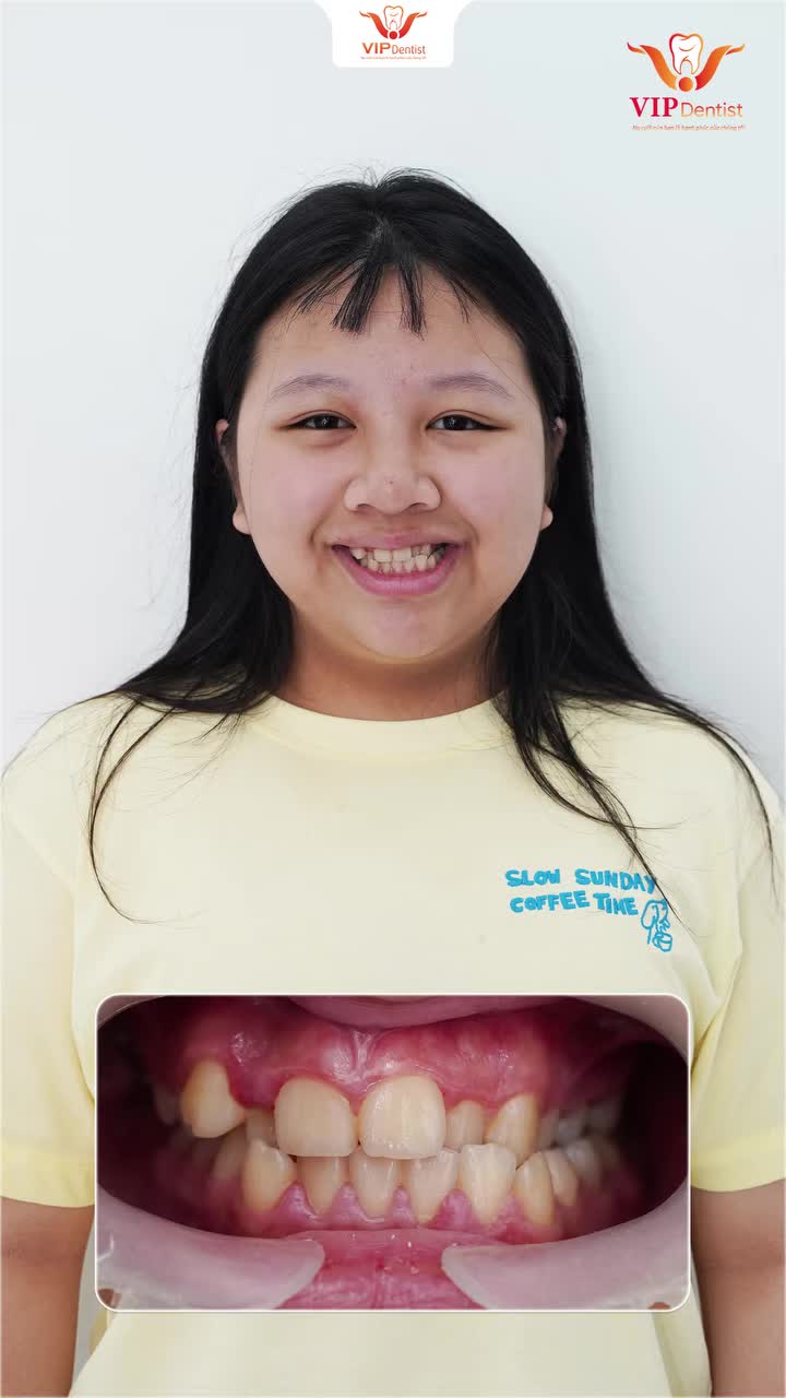 CHÀO ĐÓN CÁC ĐỒNG NIỀNG MỚI ĐẾN VỚI NHA KHOA VIP DENTIST!!!
