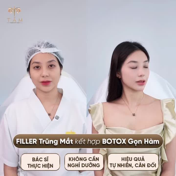 Cùng lắng nghe những chia sẻ chân thật của Hồng Thắm sau khi trải nghiệm phác đồ cá nhân hóa với Filler trũng mắt kết hợp Botox thon gọn hàm.