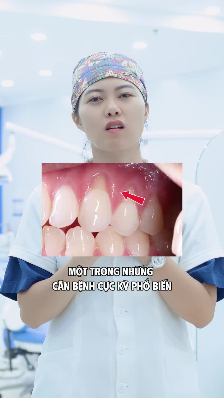 Mòn cổ răng có nguy hiểm không