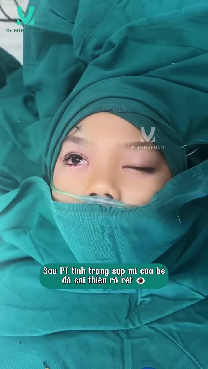 HÀNH TRÌNH HỒI PHỤC SAU TREO MI VCT.