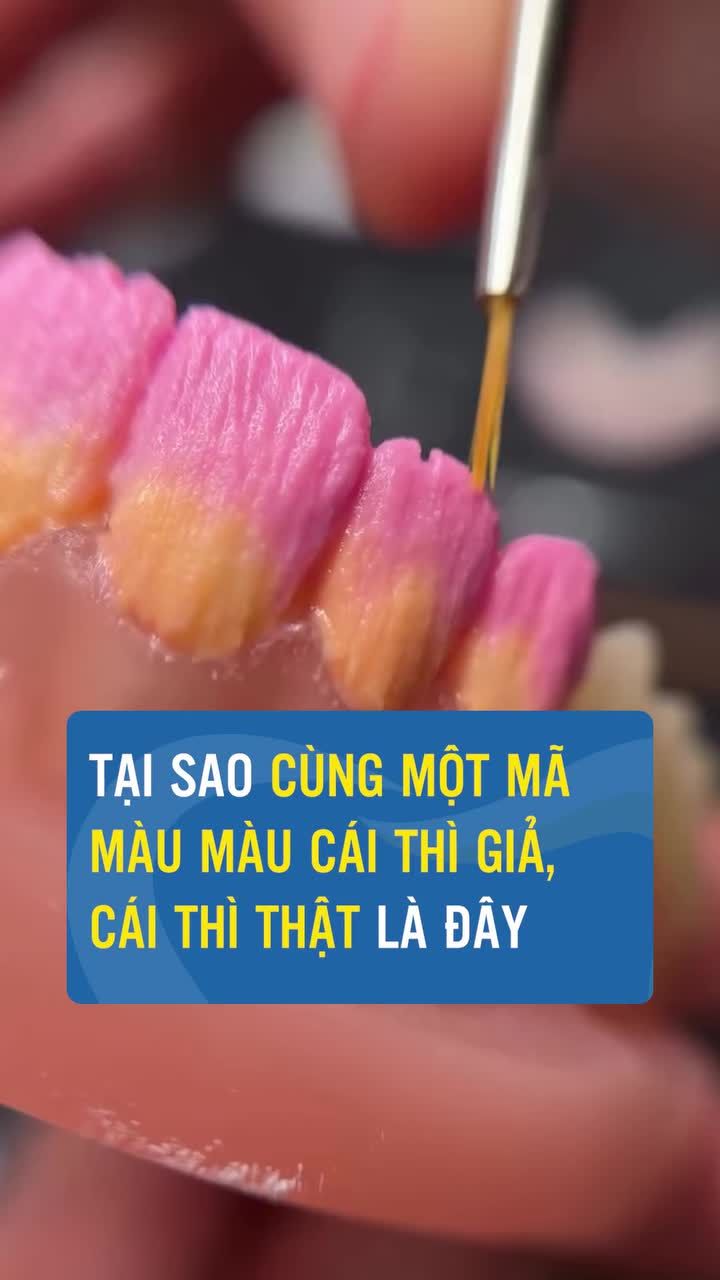 Bí mật màu răng sứ