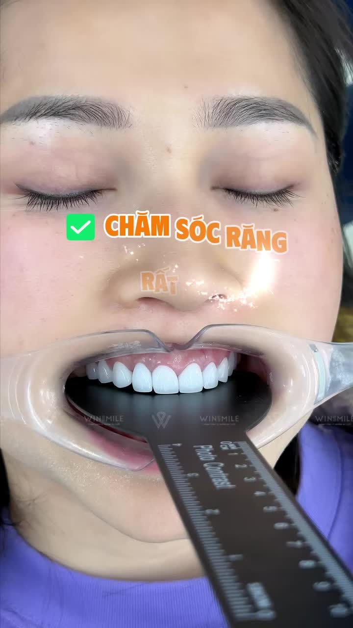 Sợ ê buốt, sợ mài hỏng răng, sợ ảnh hưởng đến việc ăn nhai... - những nỗi lo đã khiến rất nhiều chị em chần chừ, dù trong lòng luôn mong muốn có một nụ cười tự tin hơn