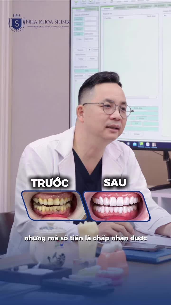 Làm 28 răng sứ 80 triệu không hề đắt nếu chọn đúng nơi uy tín.