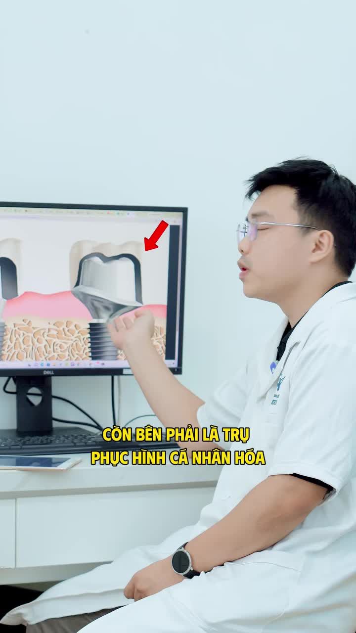 TRỤ PHỤC HÌNH CÁ NHÂN HÓA VÀ TRỤ PHỤC HÌNH BÁN SẴN – KHÁC NHAU Ở ĐIỂM NÀO?