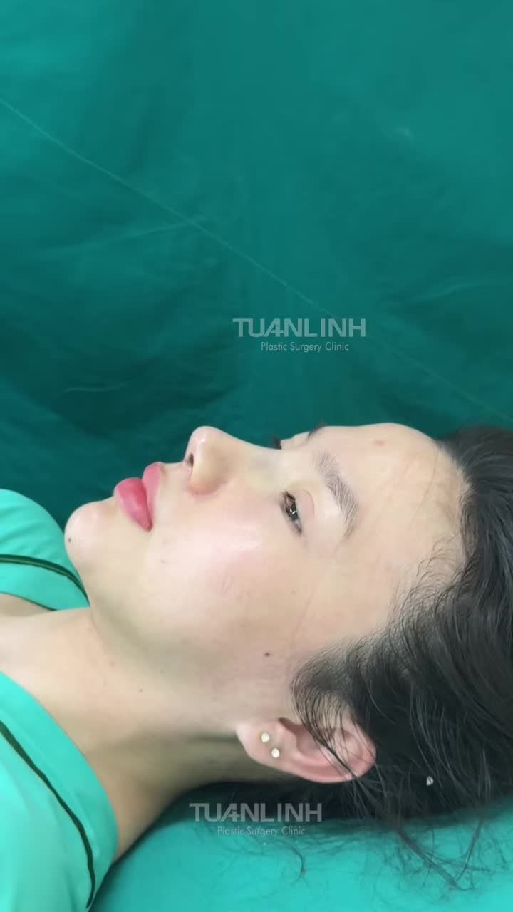 DÁNG MŨI NÂNG TẦM NHAN SẮC – CHỈ MỘT THAY ĐỔI, KHÍ CHẤT KHÁC BIỆT!