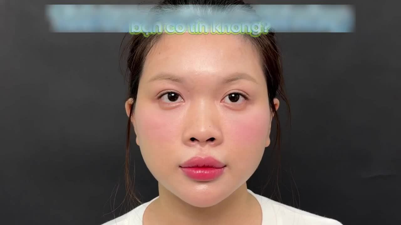 ĐỪNG ĐẶT CƯỢC VÀO NHỮNG DÁNG MŨI RẬP KHUÔN - THỜI ĐẠI BÙNG NỔ DÁNG MŨI THIẾT KẾ RIÊNG CHO TỪNG GƯƠNG MẶT