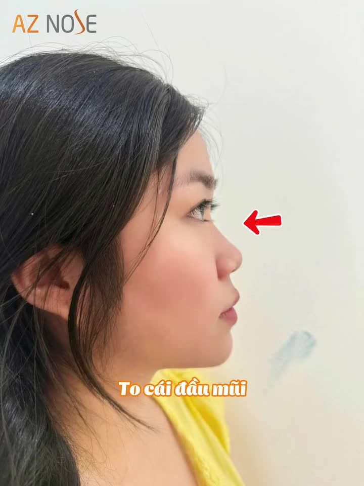 Review "trộm vía" của khách hàng 2K4 đến từ Lâm Đồng sau 8ngày