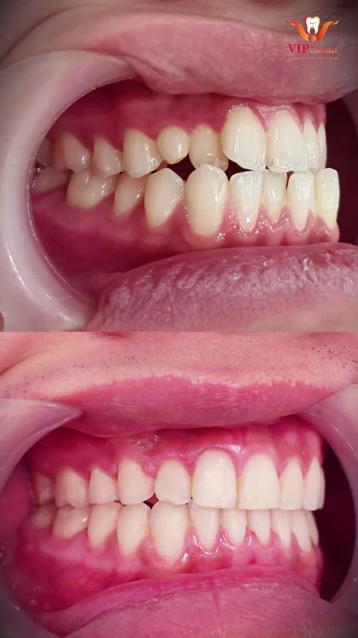 THAY ĐỔI ĐỂ TỐT HƠN!