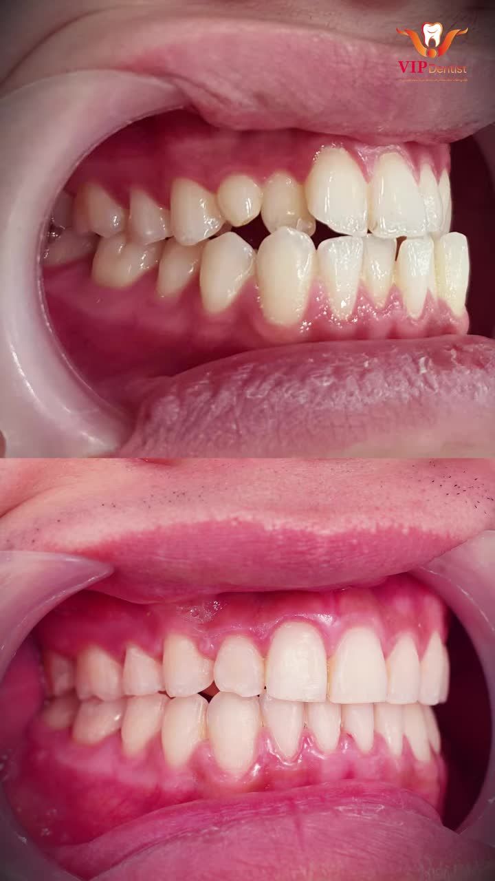 THAY ĐỔI ĐỂ TỐT HƠN!