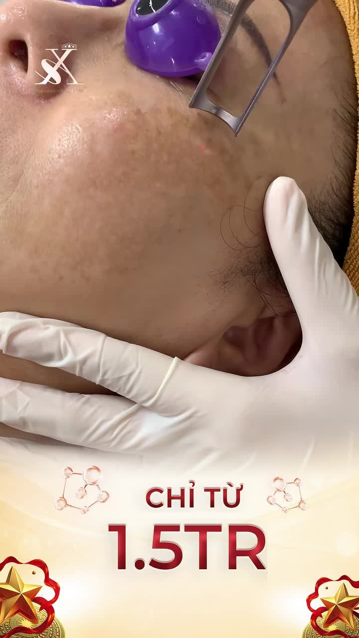 CHỈ 1TR5 ​​​​​​​ Hỗ trợ cải thiện NÁM – TÀN NHANG – ĐỐM NÂU – SẠM DA – DA KHÔNG ĐỀU MÀU bằng công nghệ PicoSure của Mỹ.