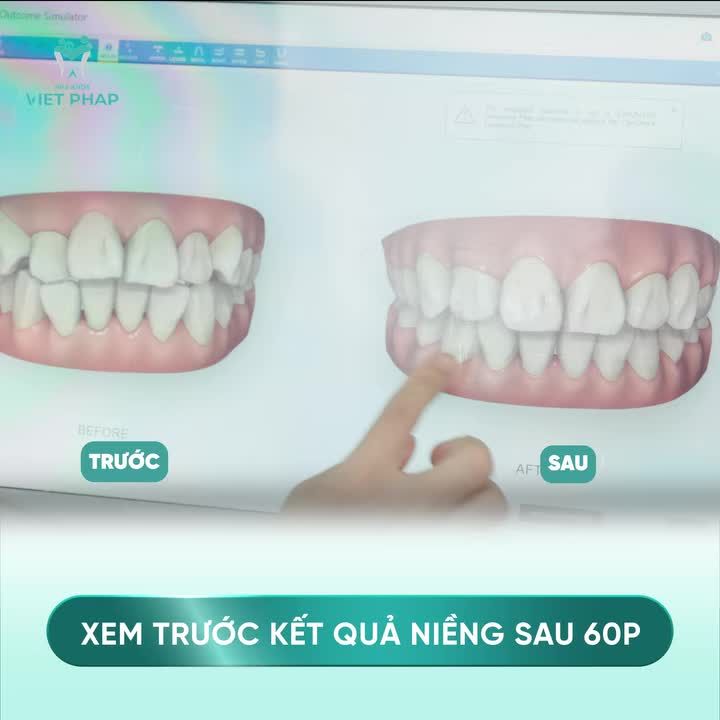 CÔNG NGHỆ XEM TRƯỚC KẾT QUẢ NIỀNG SAU 60P