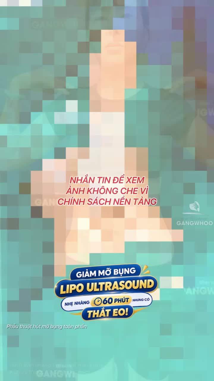 Tập gym mãi nhưng chưa có thắt eo và kết quả sau 60 phút giảm mỡ tại Lipo Ultrasound