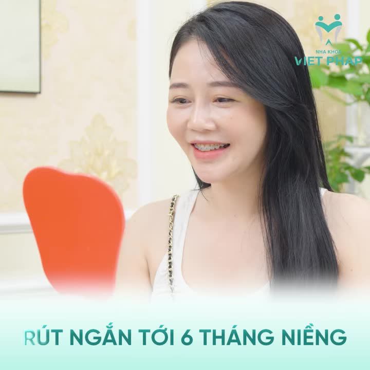 NIỀNG RĂNG KHẤP KHỂNH MẤT BAO LÂU?