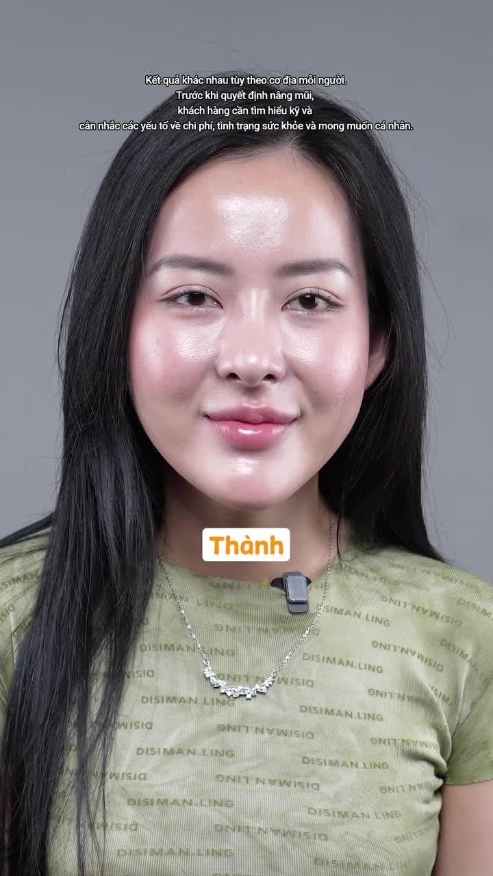 Từng bị gia đình ngăn cản chuyện nâng mũi, cô nàng vẫn quyết tâm thay đổi và giờ đã tự tin hơn với diện mạo mới của mình.