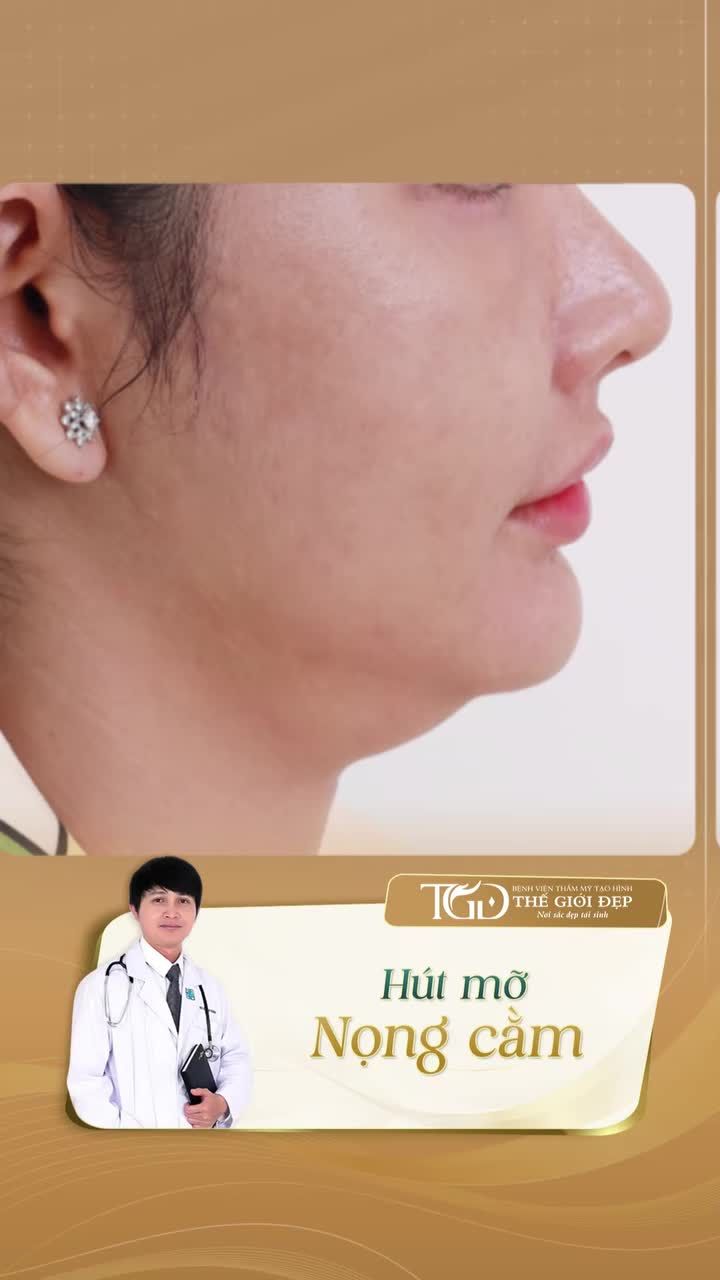 Khi nọng cằm che khuất viền hàm, giải pháp nào giúp gương mặt thanh thoát hơn