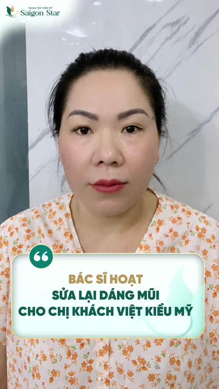 THÀNH CÔNG GIẢI CỨU MŨI HỎNG GIÚP CHỊ KHÁCH VIỆT KIỀU MỸ LẤY LẠI TỰ TIN