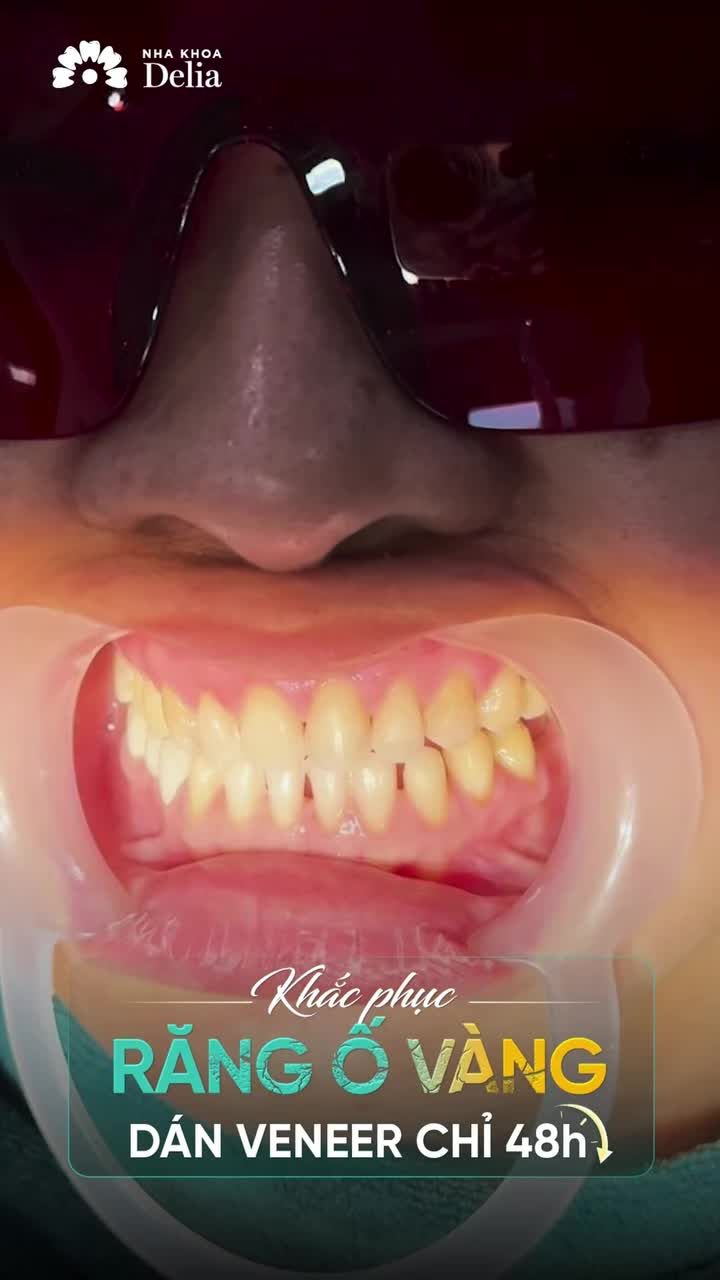 "Một công đôi việc: Vừa thăm người thân - Vừa có bộ răng sứ mới đẹp hơn, tự tin hơn. Quá lãi!!"