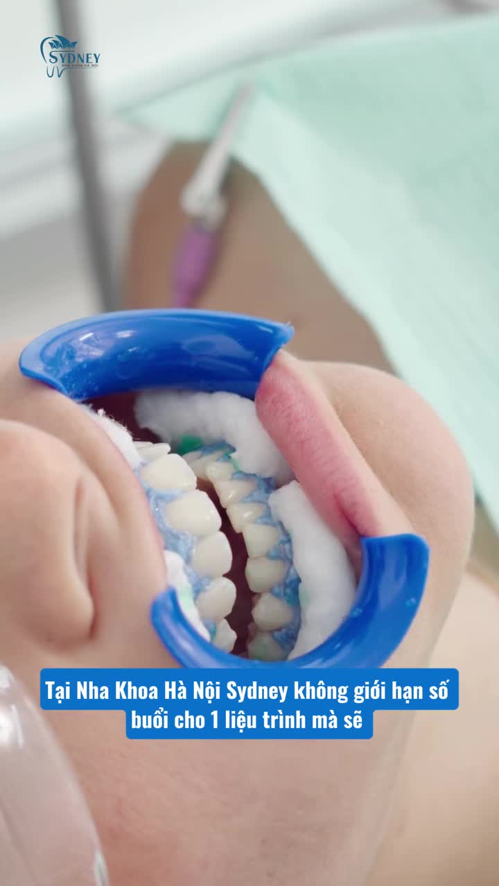LIỆU TRÌNH TẨY TRẮNG RĂNG TẠI NHA KHOA HÀ NỘI SYDNEY
