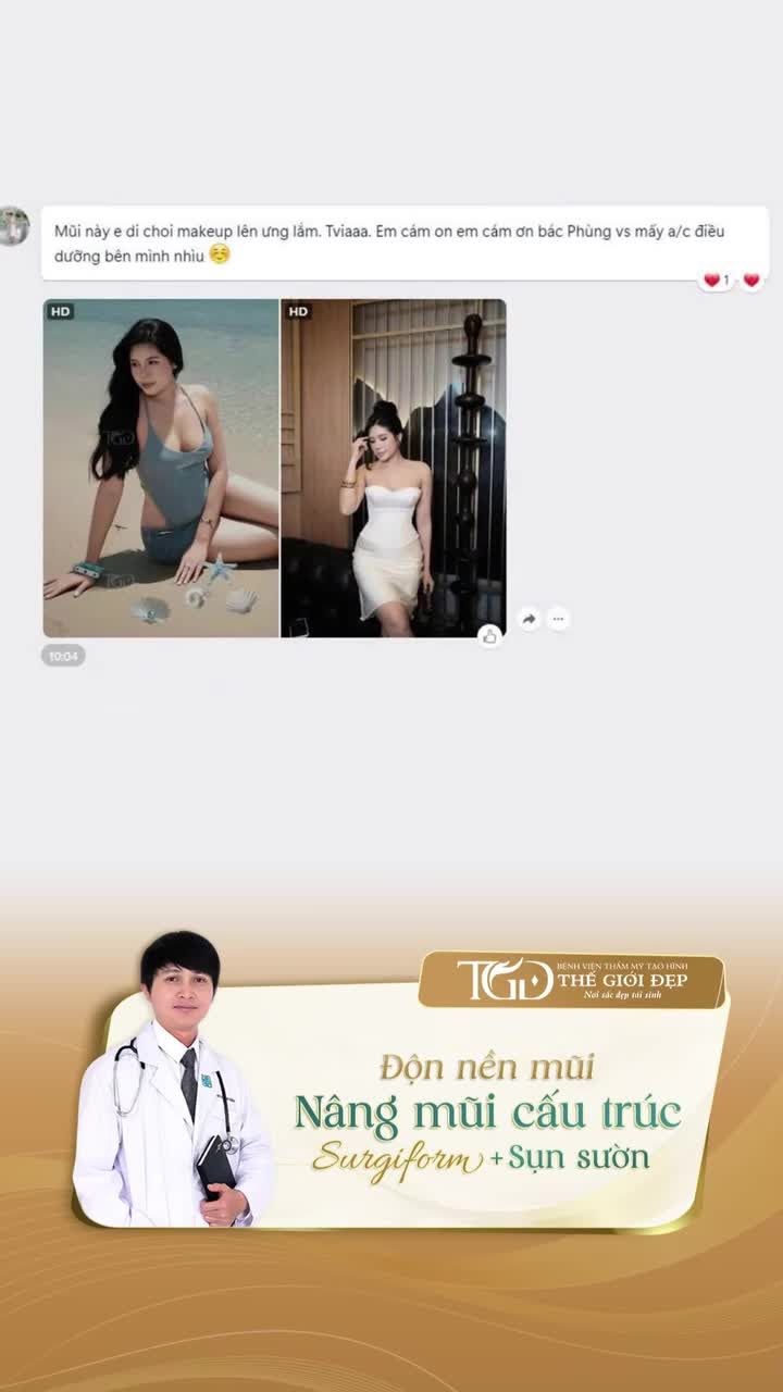 Nâng mũi cấu trúc kết hợp độn nền mũi