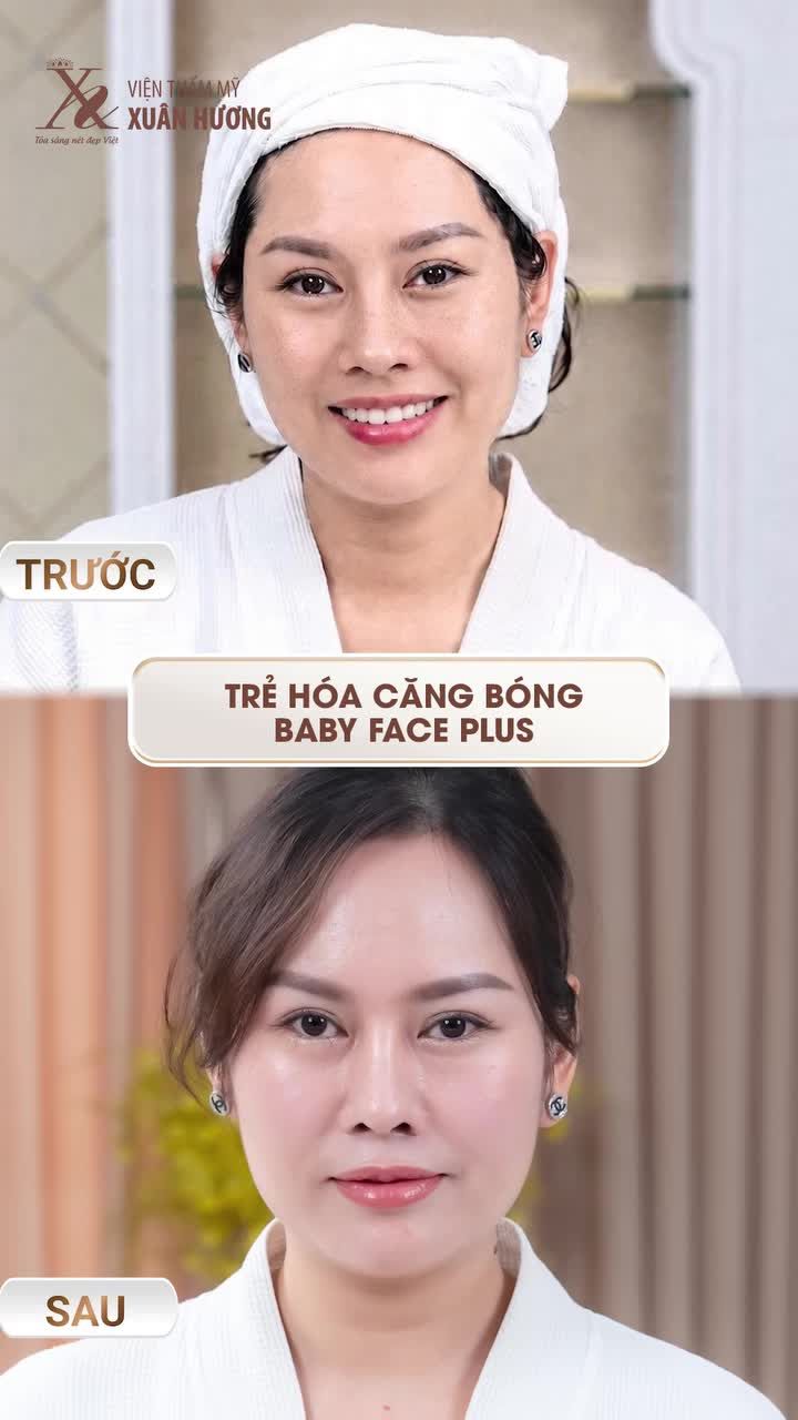 BÙNG NỔC HƯA TỪNG CÓ TRẺ HÓA CĂNG BÓNG DA BABY FACE PLUS GIẢM 80% 5tr GIẢM CÒN 999K