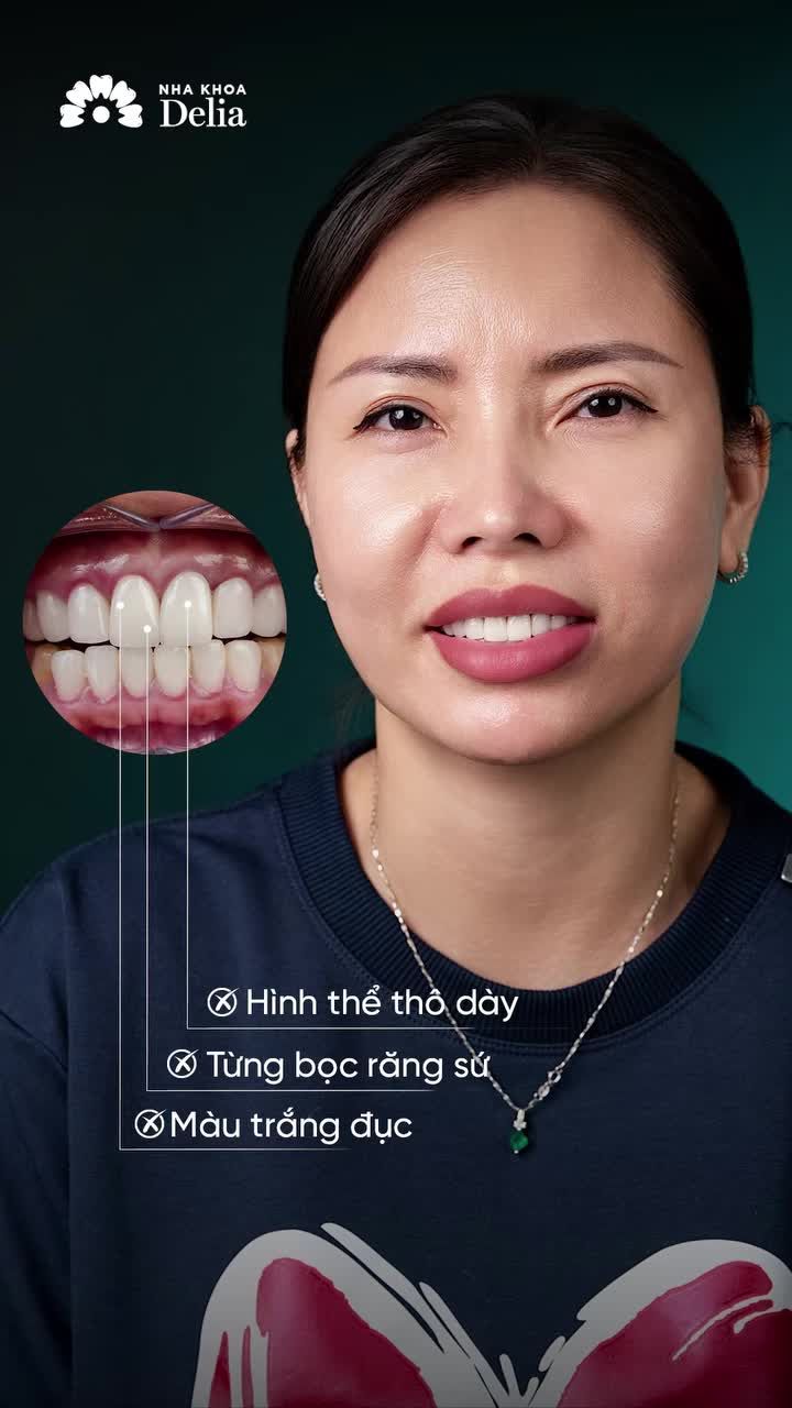 "Delia làm thẩm mỹ răng sứ đẹp. Bảo sao ai cũng muốn về làm răng."