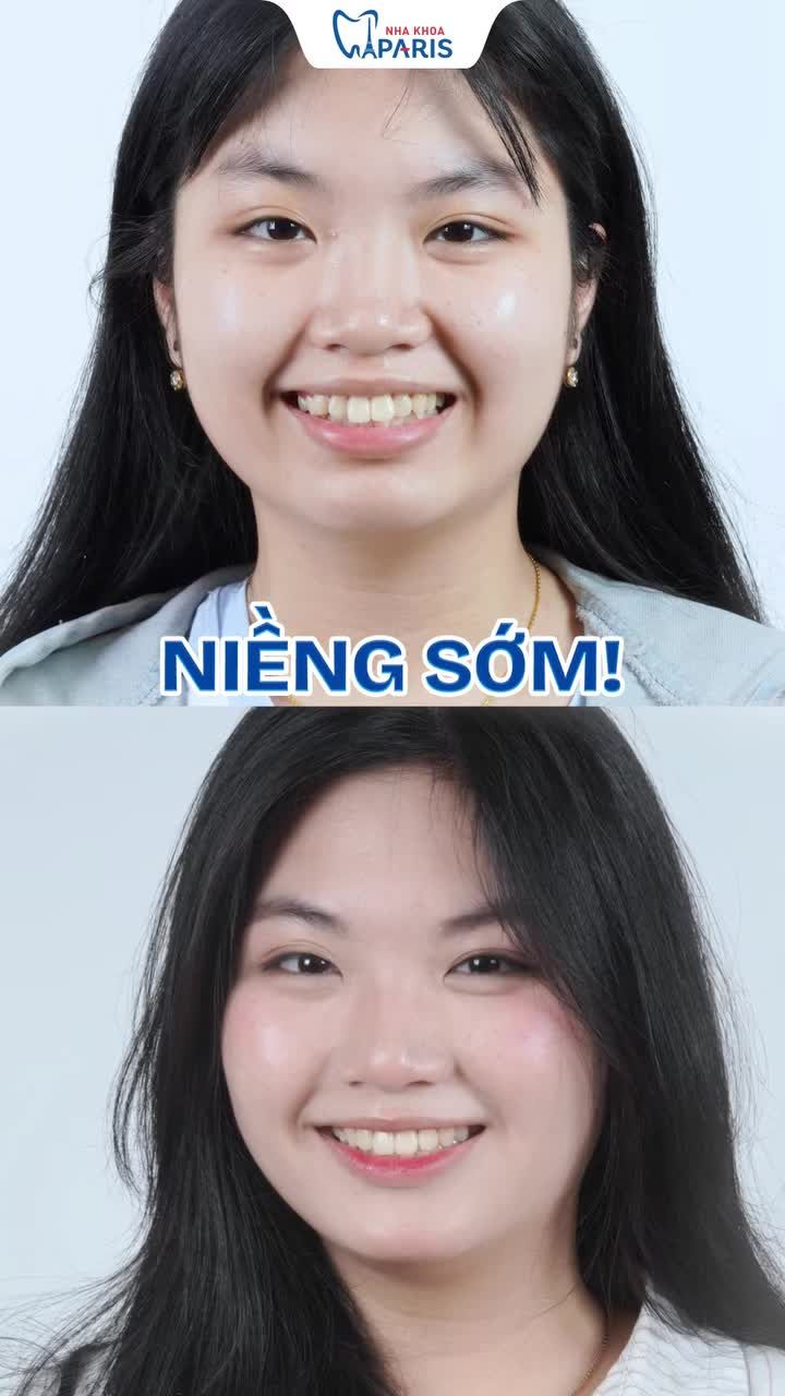 QUYẾT ĐỊNH ĐÚNG ĐẮN NHẤT ĐỜI MÌNH: ĐI NIỀNG RĂNG SỚM!