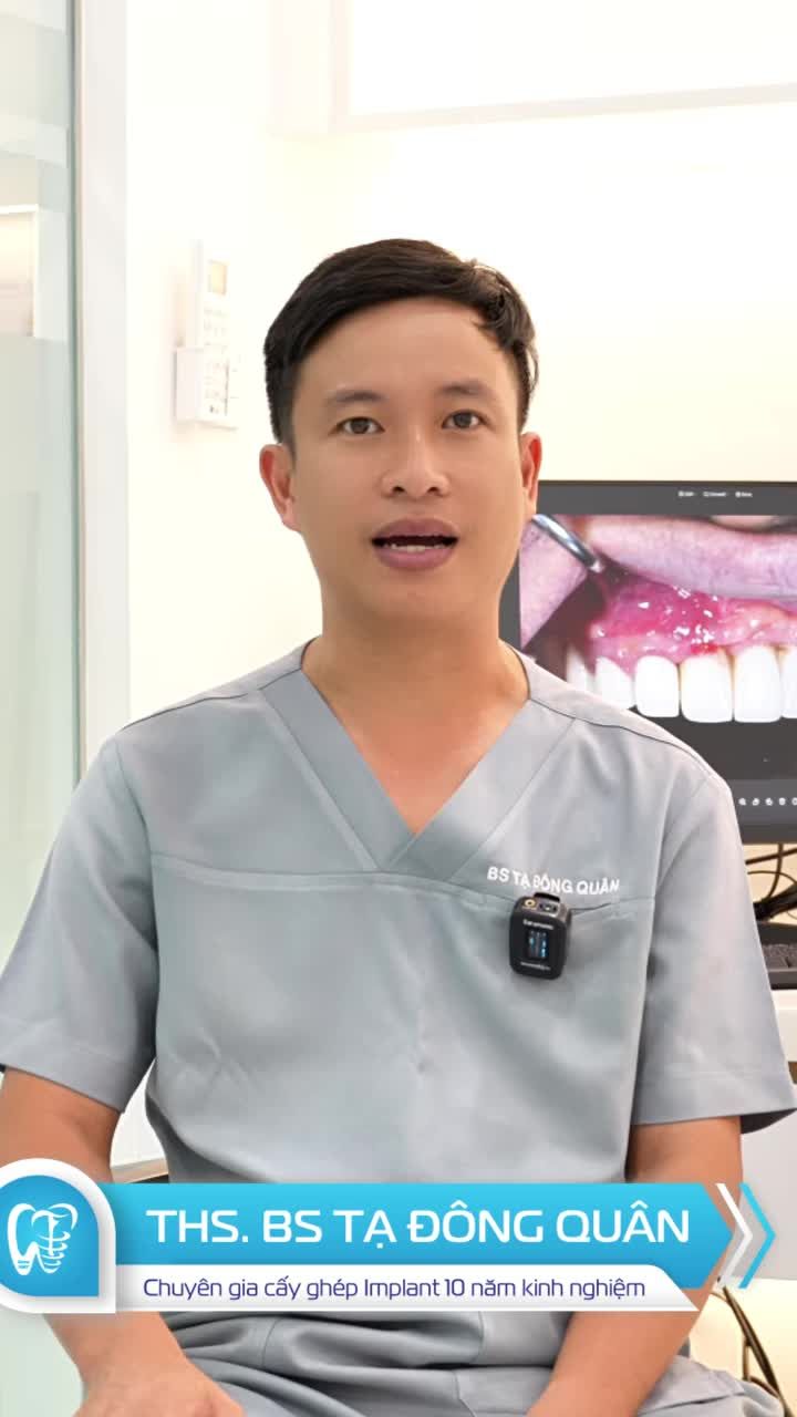 VIÊM IMPLANT BẮT ĐẦU TỪ NHỮNG DẤU HIỆU RẤT NHỎ