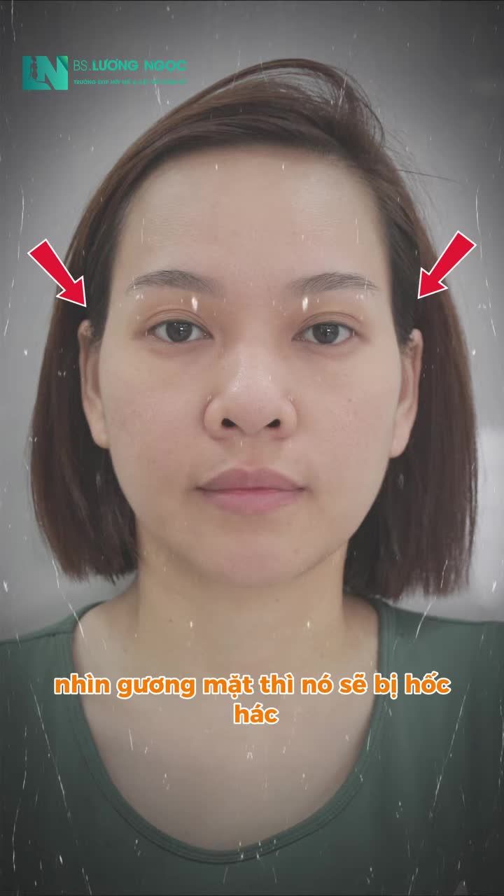 Có phải đây cũng là điều nhiều chị em mong muốn khi tìm đến cấy mỡ mặt?