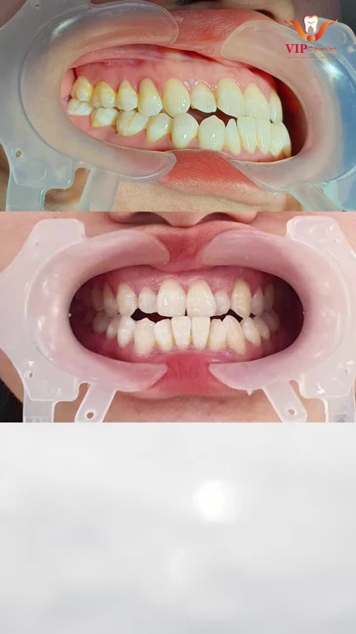 TUỔI 37 VÀ HÀNH TRÌNH TÌM LẠI NỤ CƯỜI RẠNG RỠ!