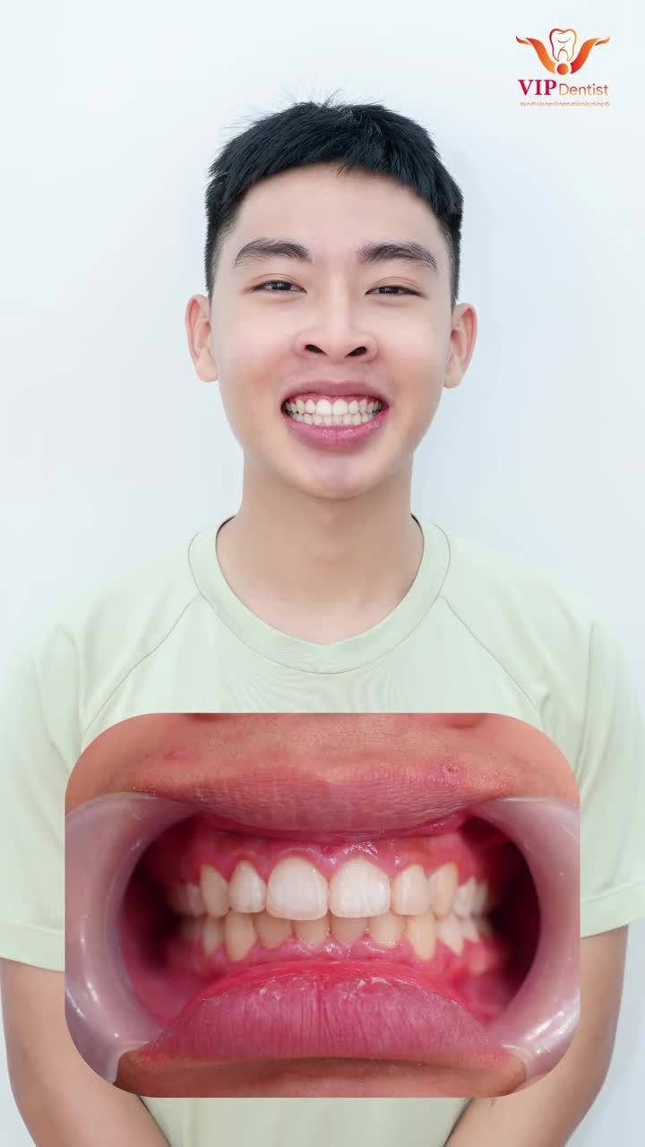TRƯỞNG THÀNH CÙNG NỤ CƯỜI MỚI