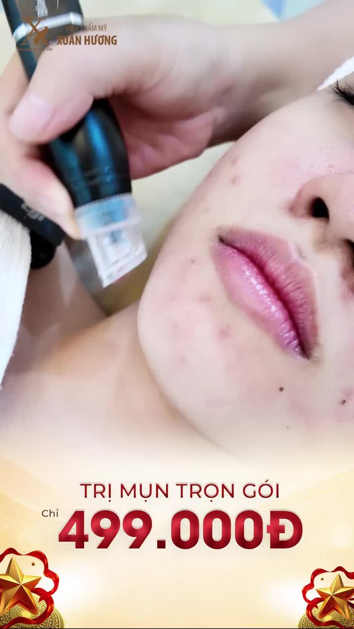 DUY NHẤT TRONG THÁNG 9: TRỊ MỤN TRỌN GÓI CHỈ VỚI 499K