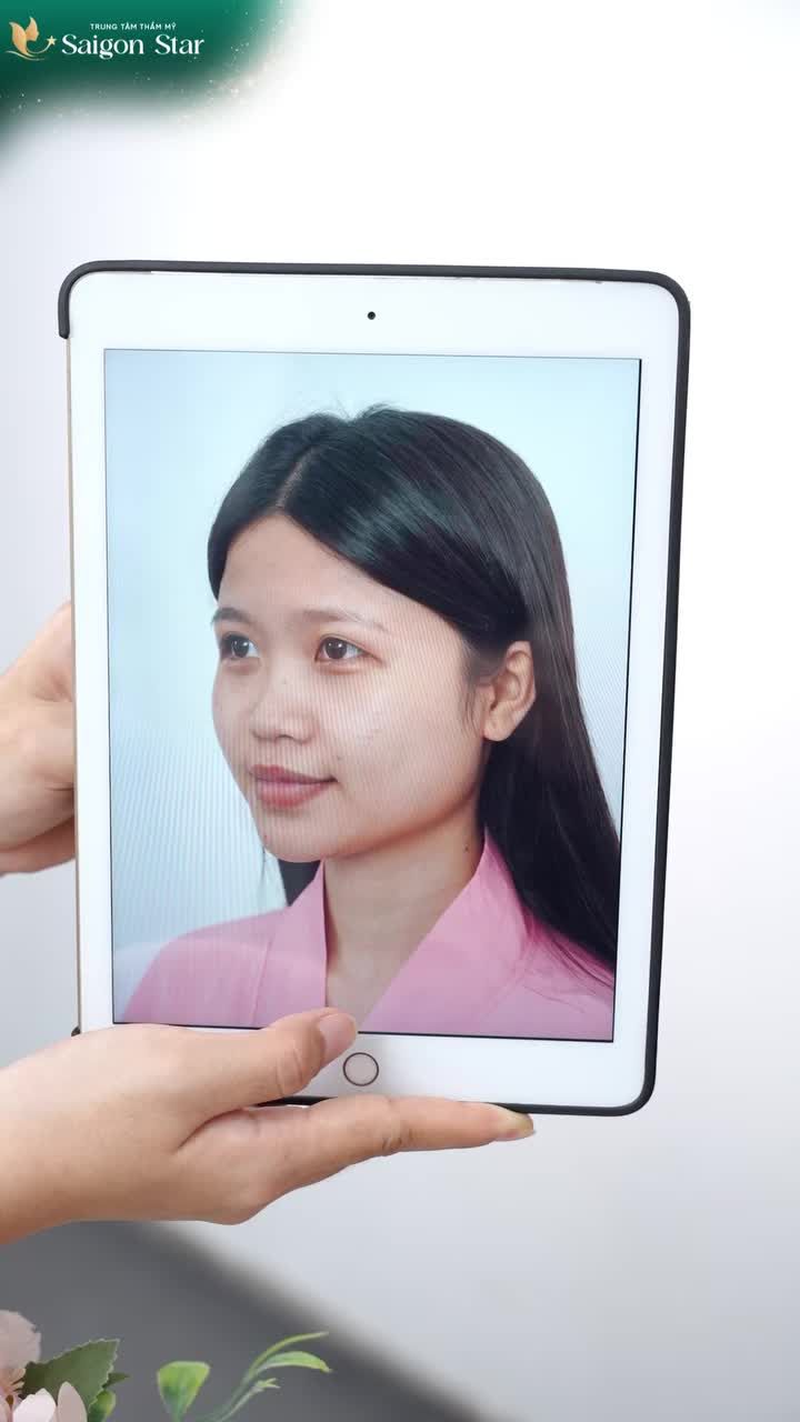 NÂNG MŨI XONG QUÊN LUÔN PHIÊN BẢN GỐC CỦA MÌNH