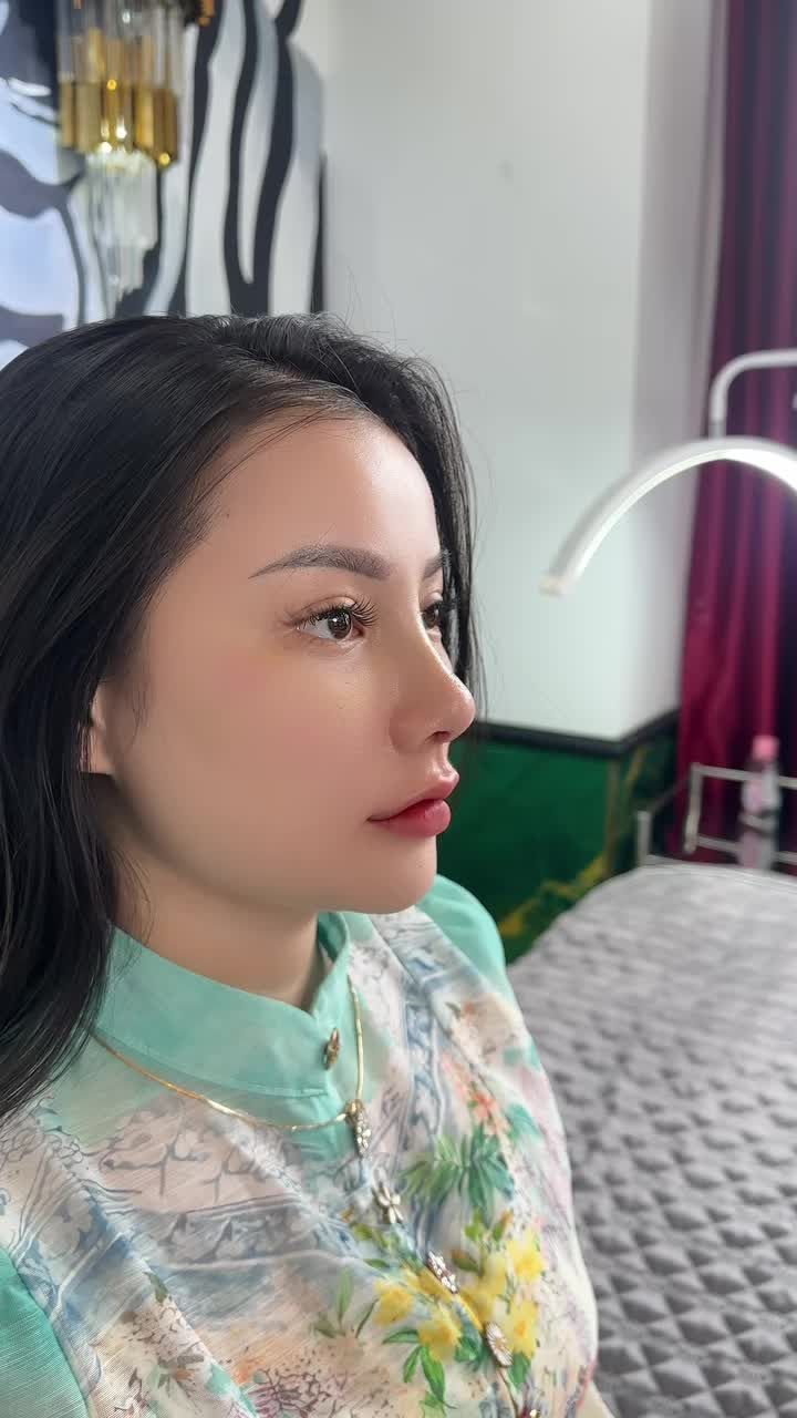Mũi cấu trúc 10 ngày